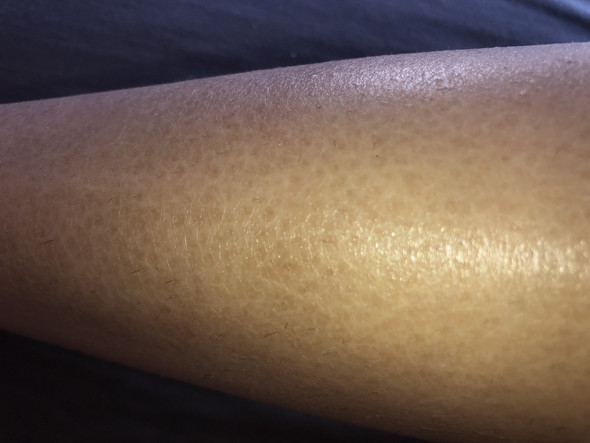 Trockene Haut An Den Beinen Oder Gesundheit Und Medizin Madchen Frauen