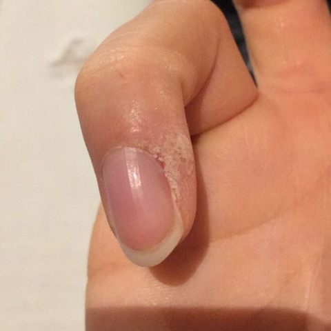 Stelle am Finger - (Gesundheit und Medizin, Arzt, Krankheit)