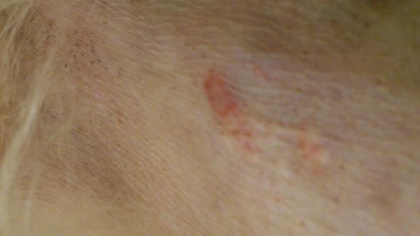 Tumor beim Hund / Hautprobleme
