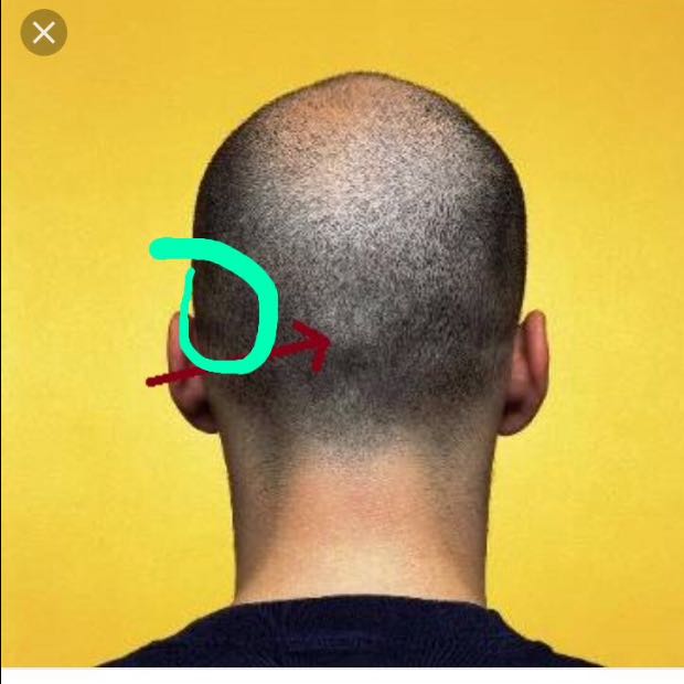 Tumor im Kopf oder nicht? (Gesundheit, Arzt, Krebs)