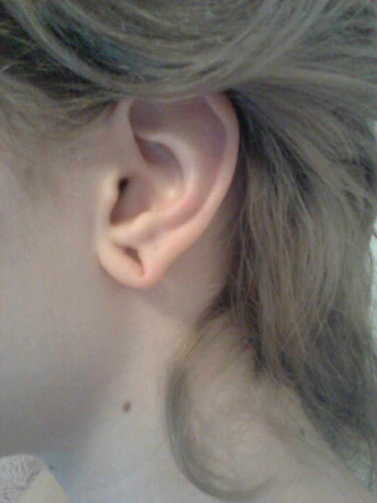 Tunnel Am Besten Zuwachsen Lassen Piercing Ohrloch