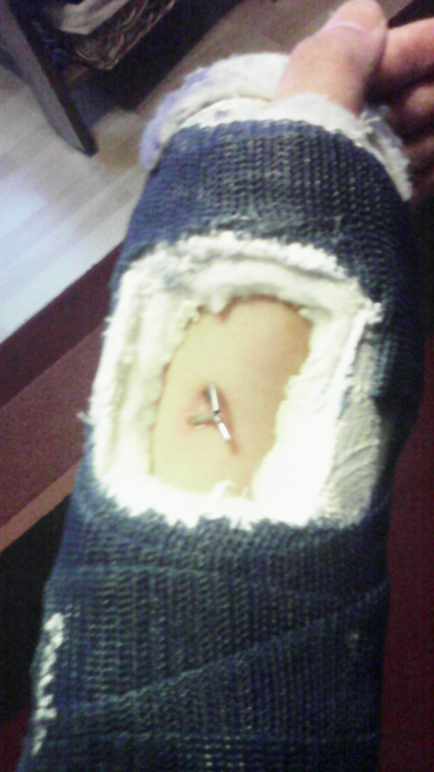 Tut Es Weh Wenn Man Zwei Drähte Aus Dem Arm Gezogen Tut Es Weh Wenn Man Zwei Drähte Aus Dem Arm Gezogen