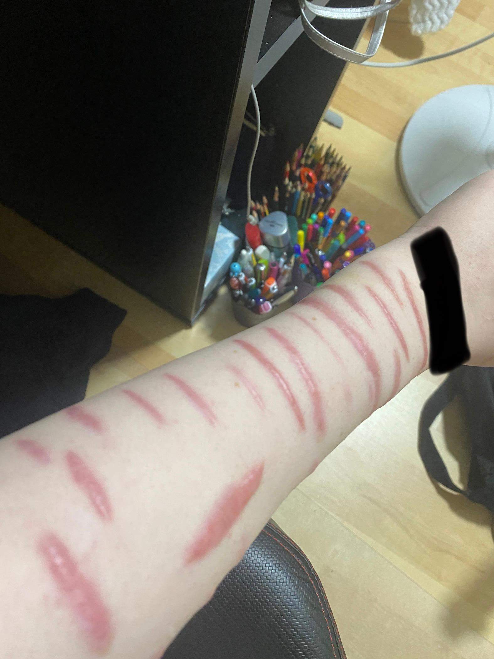Über diese Narben tätowieren? (Körper, Haut, Tattoo)