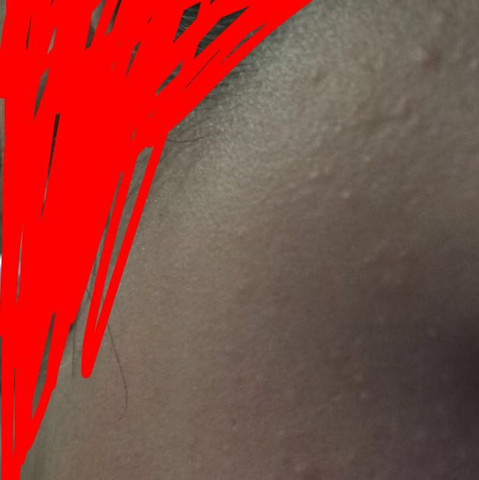 Versuche morgen mal bessere Bilder zu machen da es nicht gut zu erkennen ist - (Pickel, Gesicht, Ausschlag)