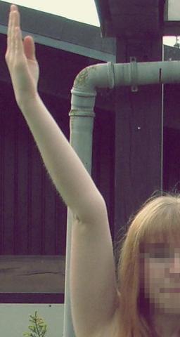 das ist mein Arm. - (Arm, überdehnt)