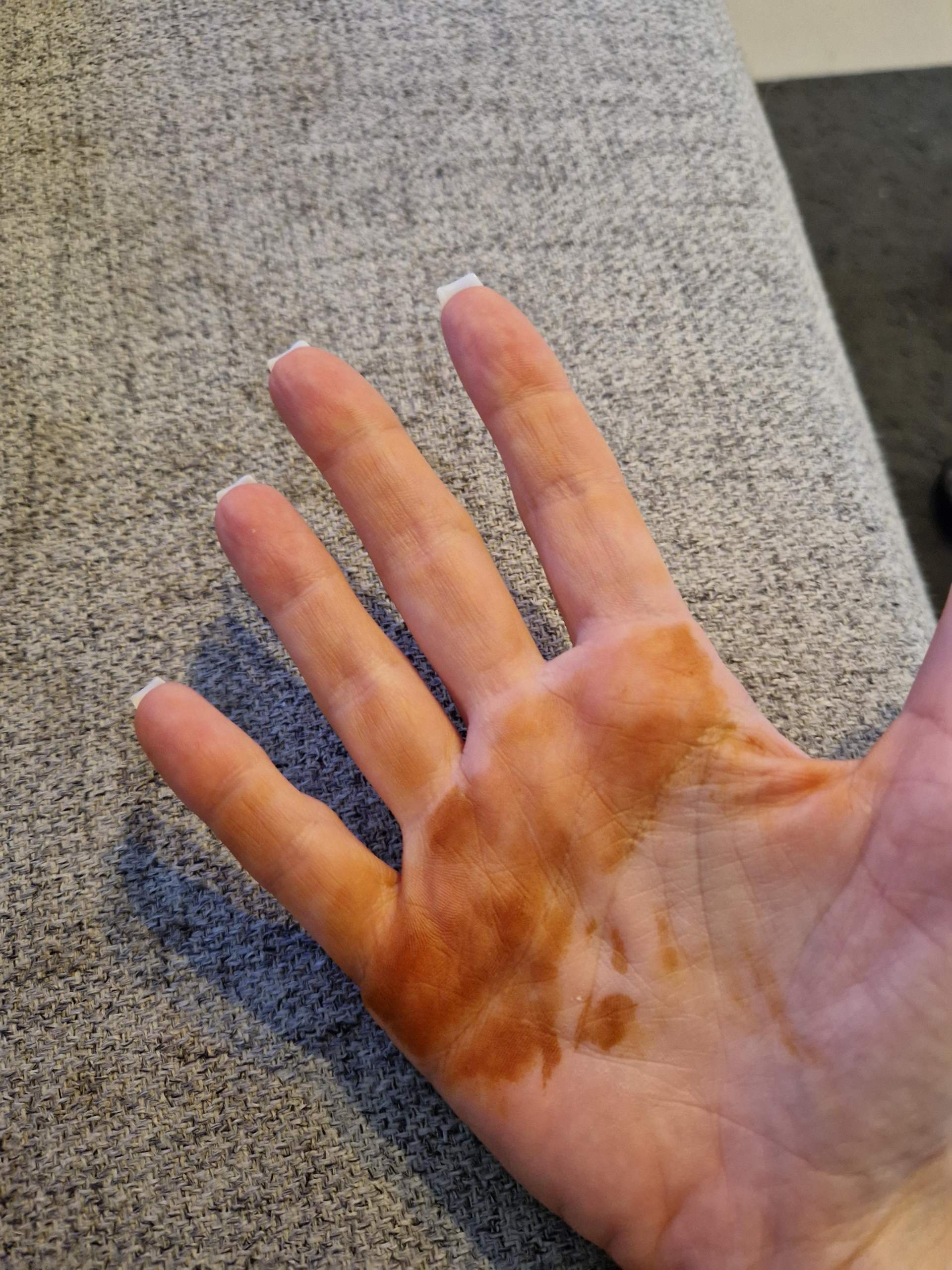 bernacht Flecken Auf Der Hand Was Ist Das Hennafarbe bernacht-flecken-auf-der-hand-was-ist-das-hennafarbe