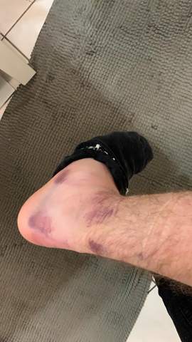 Umgeknickt Und Damit Zum Arzt Gesundheit Und Medizin Gesundheit Sport Umgeknickt Und Damit Zum Arzt Gesundheit Und Medizin Gesundheit Sport