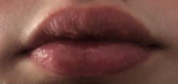 Ungerade Lippen?