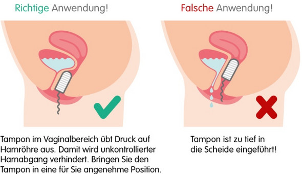 Unkontrollierten Harnverlust Durch Grosse Menstruationstasse Verhindern Gesundheit Und Medizin Sport Und Fitness Blasenschwache Unkontrollierten Harnverlust Durch Grosse Menstruationstasse Verhindern Gesundheit Und Medizin Sport Und Fitness Blasenschwache