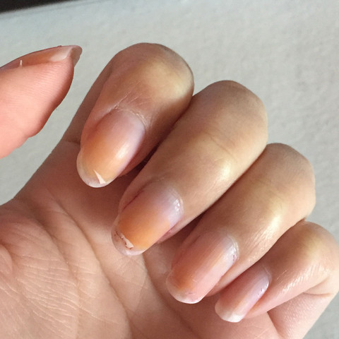 Unter Nageln Total Gelb Und Orange Was Ist Da Los Gesundheit Angst Krankheit Nagel Spaltet Sich Quer