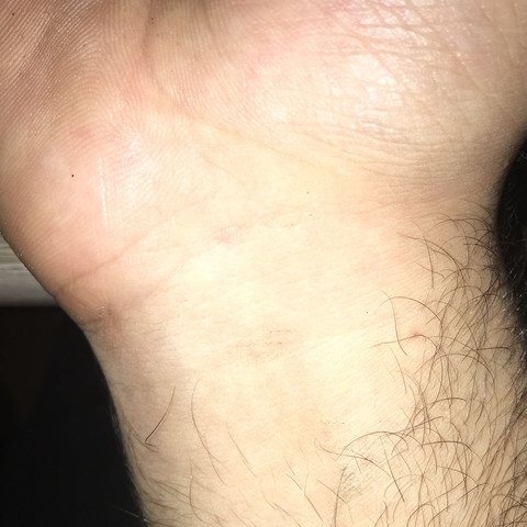 Unterarm - (Arm, Unterarm)