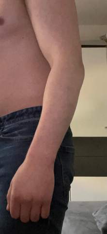 - (Gesundheit und Medizin, Körper, Kosten)
