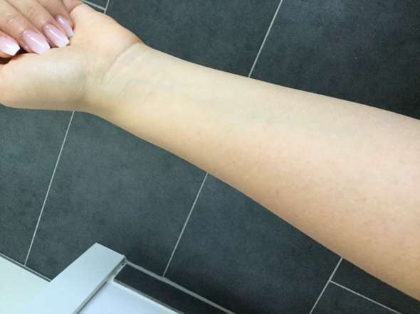 Unterarme Werden Einfach Nicht Braun Gesundheit Und Medizin Korper Haut Unterarme Werden Einfach Nicht Braun Gesundheit Und Medizin Korper Haut