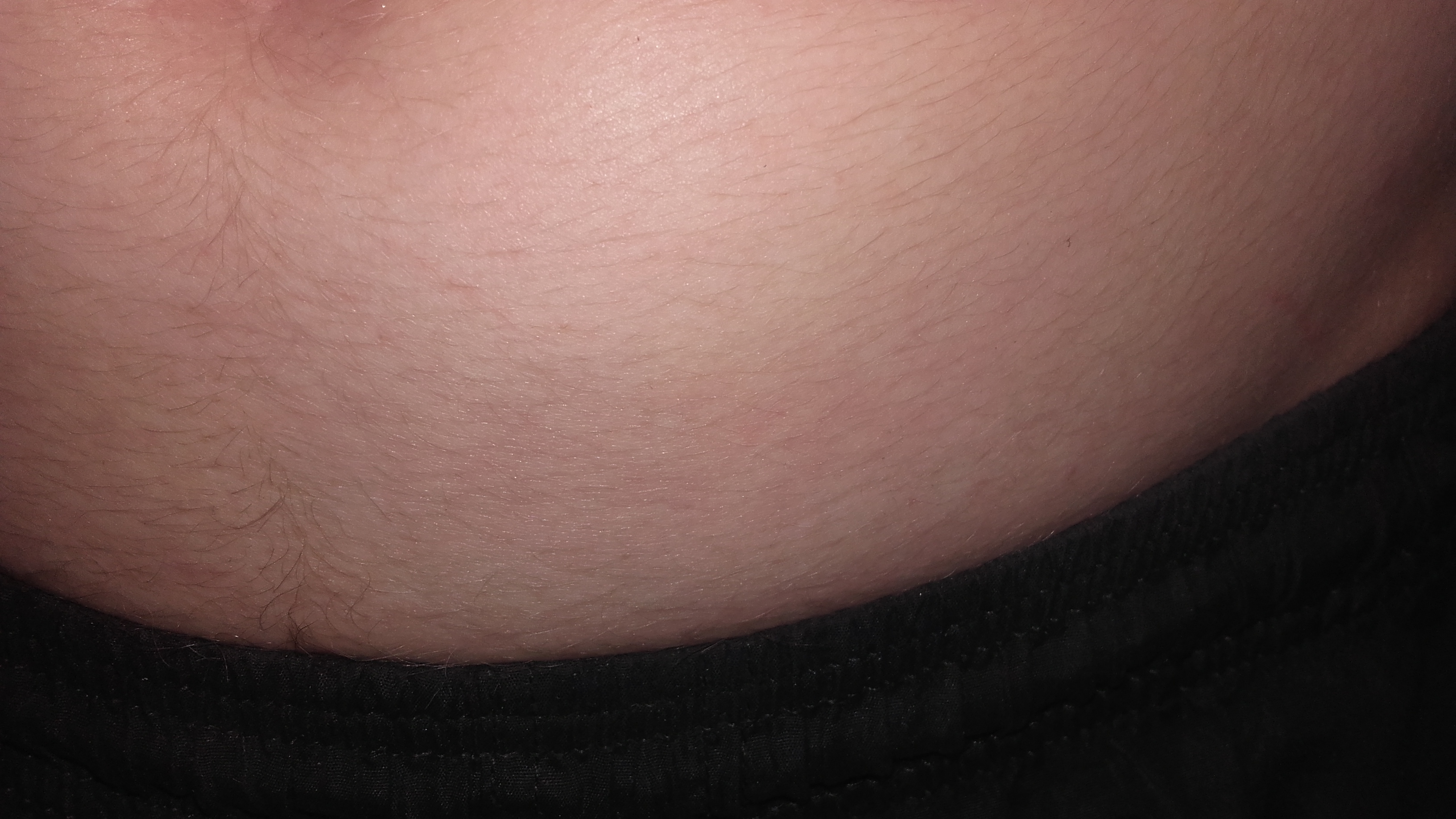 Unterleib Schmerzen und unter dem Bauchnabel wird die Haut Schwarz? (Arzt, Bauch)