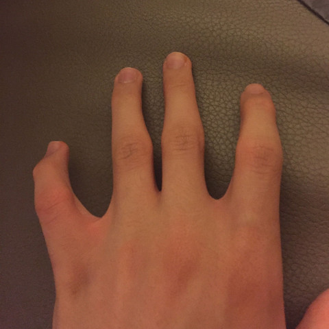 Unwohles Gefuhl In Der Hand Gefuhle Finger Knacken Unwohles Gefuhl In Der Hand Gefuhle Finger Knacken