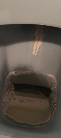 Urinstein Wc Entfernen Sehr Hartnackig Toilette Bad Klo