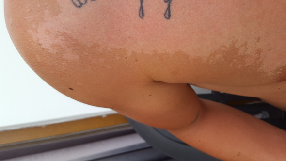 Urlaubsbraune Weg Haut Schalt Sich Was Kann Ich Tun Urlaub Sonnenbrand Aloe Vera Urlaubsbraune Weg Haut Schalt Sich Was Kann Ich Tun Urlaub Sonnenbrand Aloe Vera