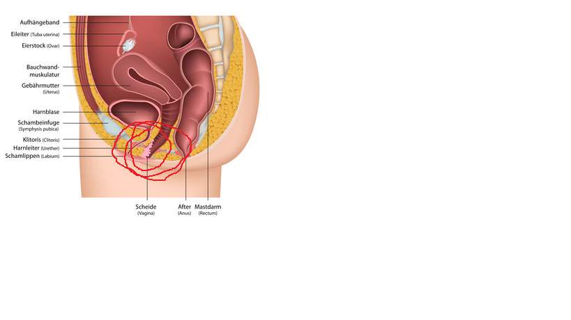 Scheide geschwulst Bartholinitis