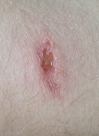 - (Gesundheit, Medizin, Arzt)