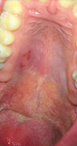 Gaumen Die Meistgelesenen Fragen Gaumen Die Meistgelesenen Fragen