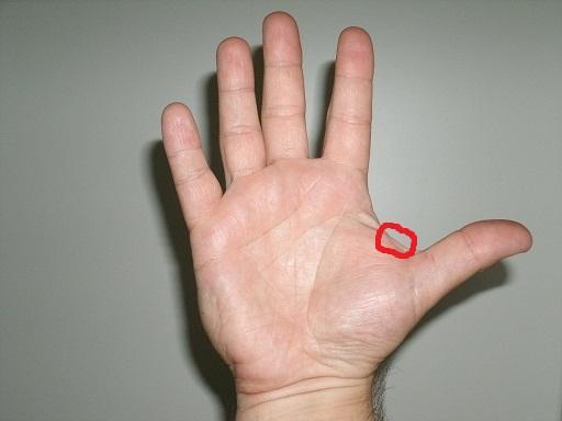 Vererbbar Adern Hand Vererbbar Adern Hand