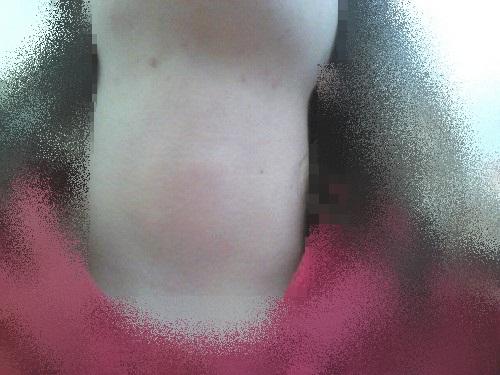 - (Arzt, Blut, Schilddrüse)