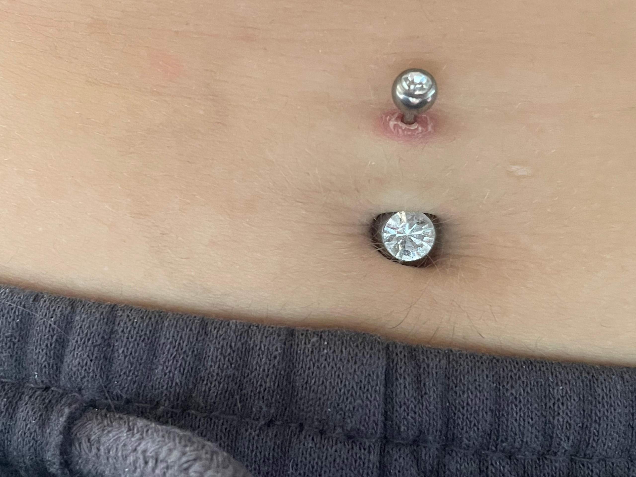 Woher weiß ich das mein Bauchnabelpiercing verheilt ist?