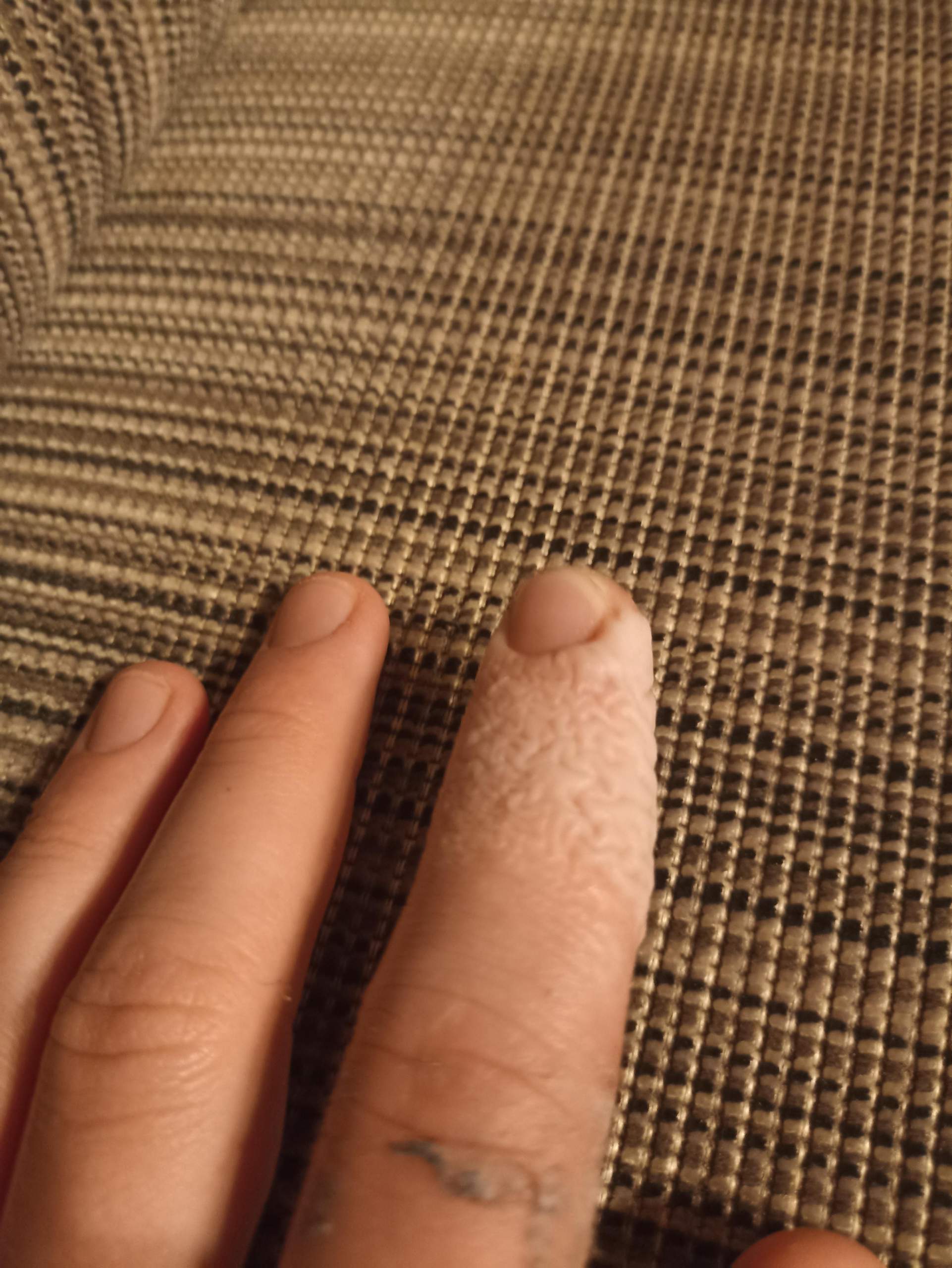 Verheilt mein Finger wieder normal? (Körper, Haut, Hand)
