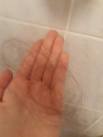 verliert ihr auch so viele haare