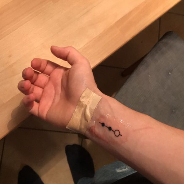 Verschmiert mein Tattoo oder was ist das los? tätowieren