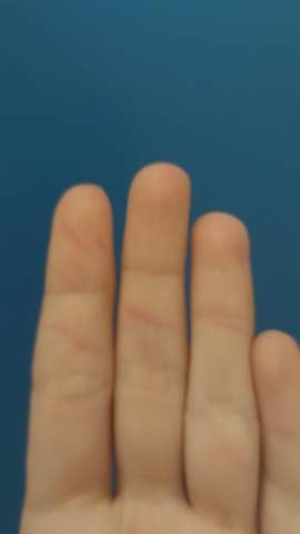 Violette Striche Finger?