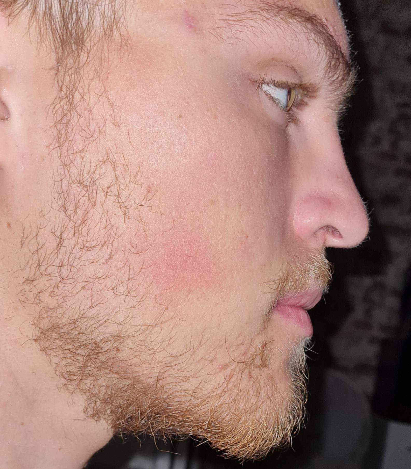 Bart Wachsen Lassen Sieht Ungepflegt Aus Vollbart wachsen lassen? (Haare, blond, Bart)