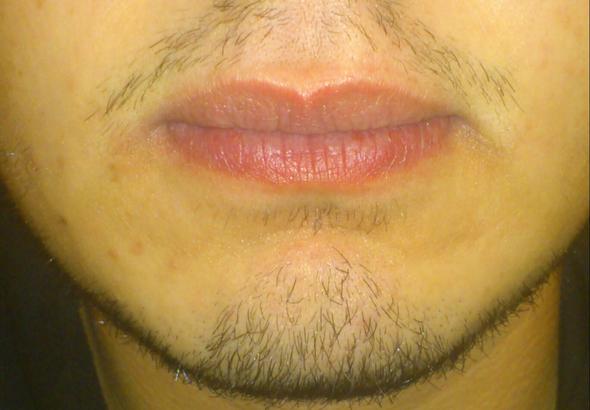 Volle Lippen Als Junge Sieht Das Hasslich Aus Lippe Voll