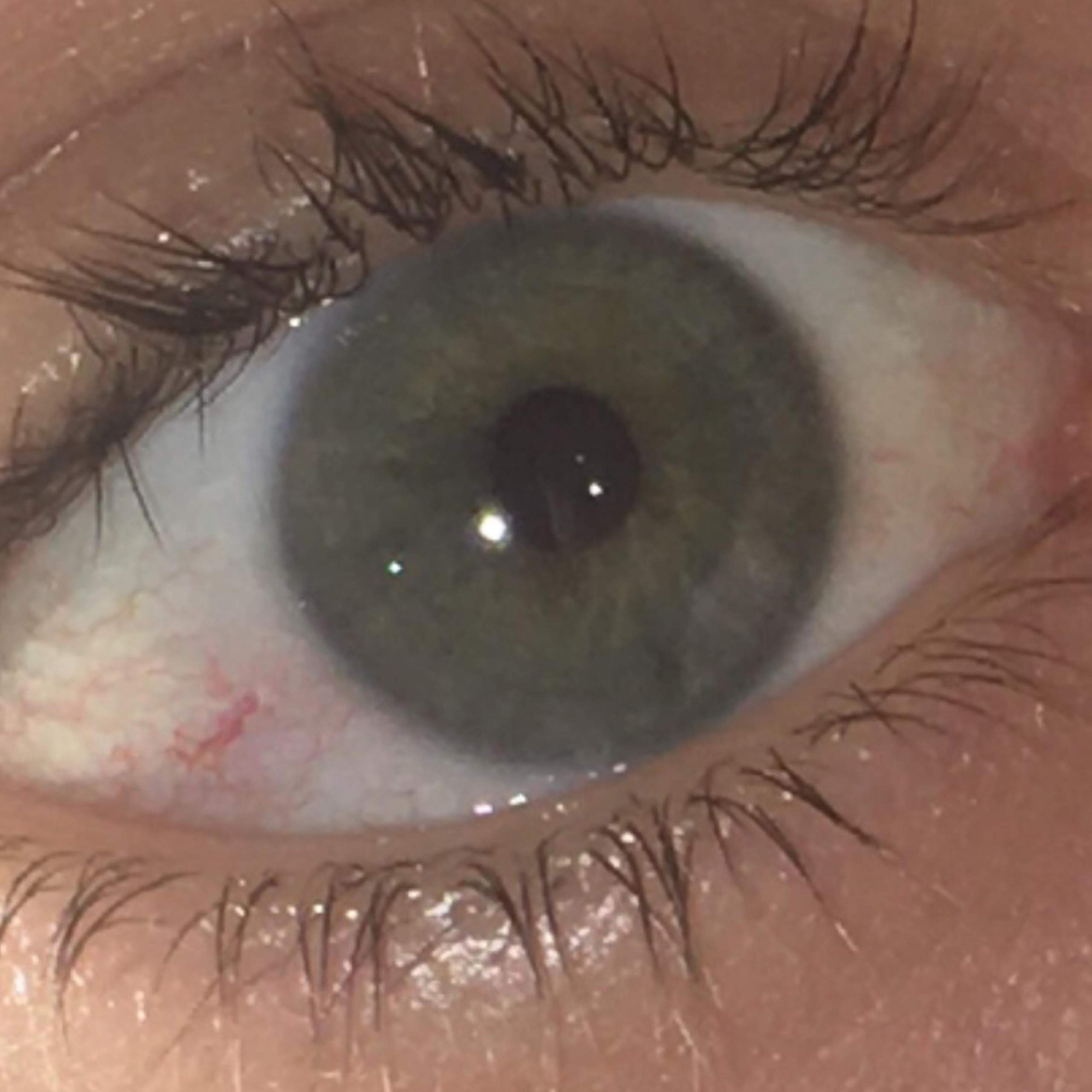 Von Blau Zu Gr n Augenfarbe Ge ndert Kinder Augen Farbe von-blau-zu-gr-n-augenfarbe-ge-ndert-kinder-augen-farbe