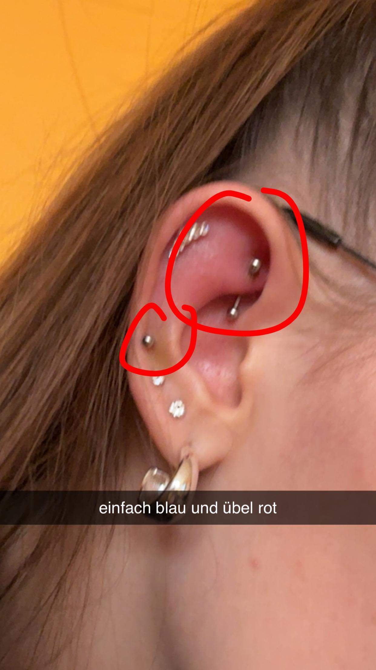 von rook piercing kopfschmerzen? (Schmerzen, Pflege, Entzündung)