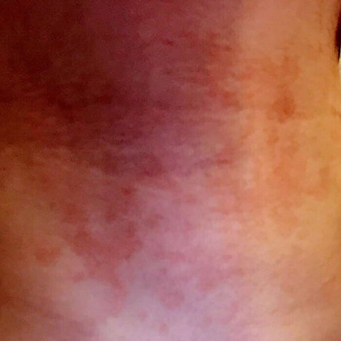 24 Flecken Kommen Durch Wandfarbe 24 Flecken Kommen Durch Wandfarbe