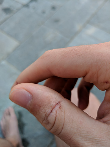 Vor 5 Tagen In Den Finger Geschnitten Gesundheit Und Medizin