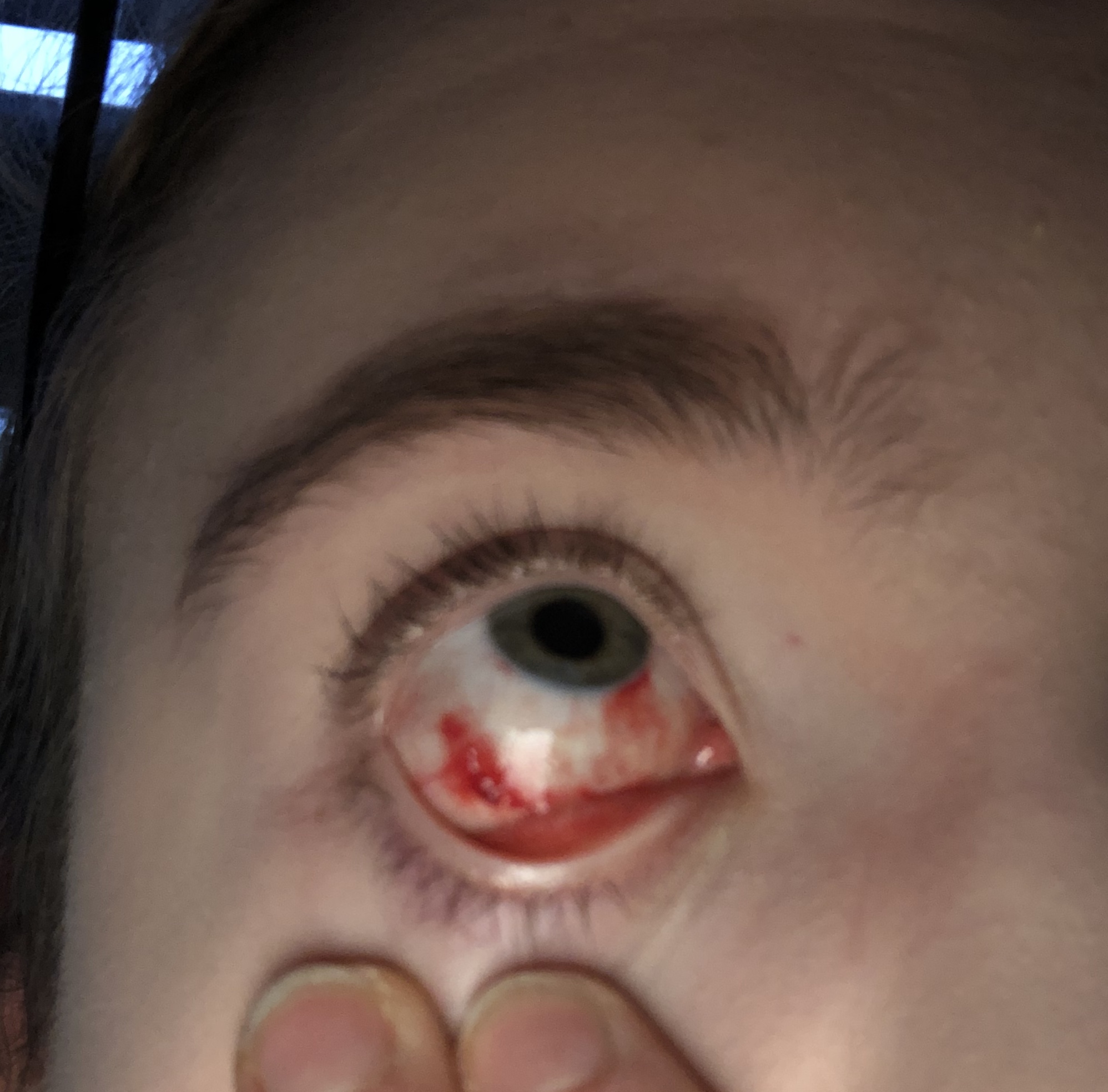 Was Bedeutet Ich Küss Dein Auge