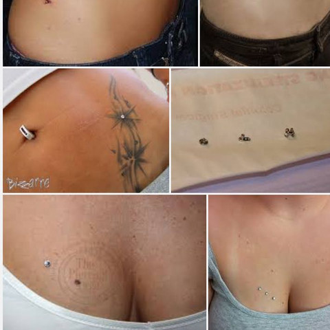 wachsen dermal anchors raus piercing