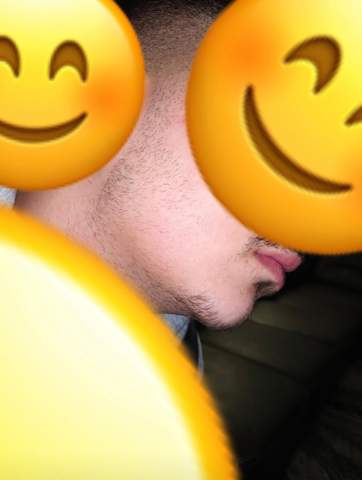 - (Haare, Bartwuchs)