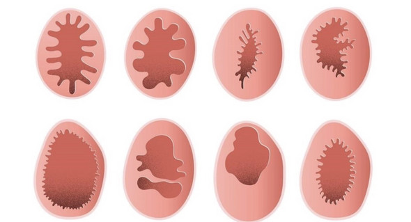 Warum besitzen Frauen ein Jungfernhäutchen ( Hymen)? (Sexualität