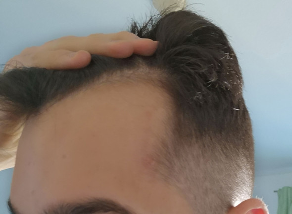 warum hab ich da so ecken an der stirn