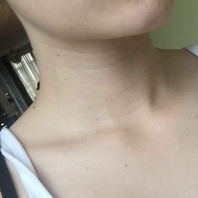 Warum Bin Ich So Blass Warum habe ich 2 Hautfarben? (normal, Hautfarbe, Blass)