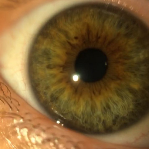 Warum Habe Ich Grune Augen Obwohl Niemand In Meiner Familie Grune Hat Augenfarbe Warum Habe Ich Grune Augen Obwohl Niemand In Meiner Familie Grune Hat Augenfarbe