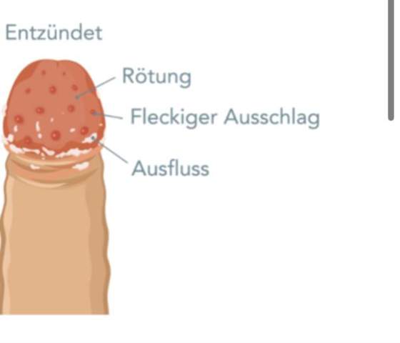 Bild zum Beitrag