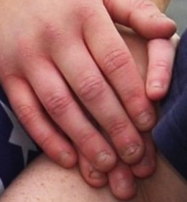 finger - (rot, Finger)