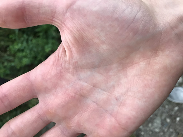 Weisse Punkte Auf Der Lippe Bilder Beste Ideen Bilder Weisse Punkte Auf Der Lippe Bilder Beste Ideen Bilder