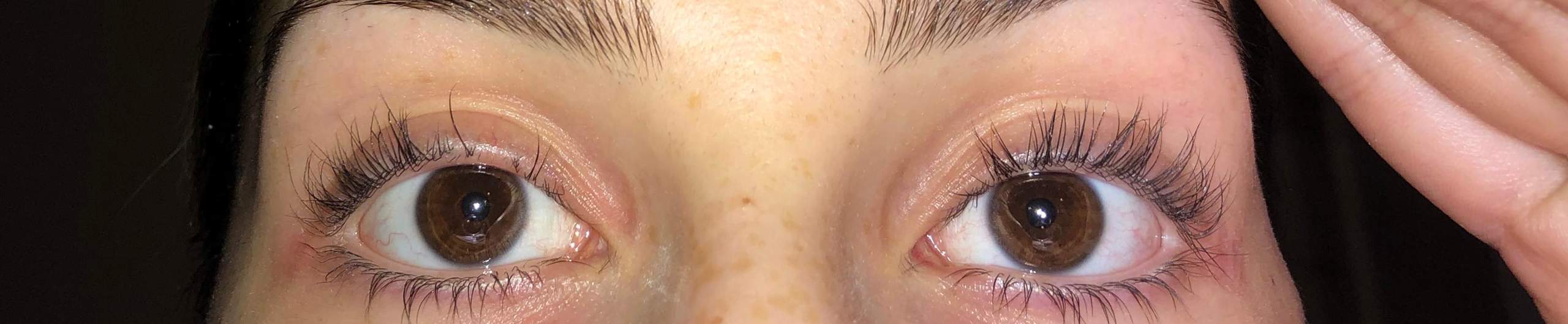 Warum habe ich Wimpernausfall? (Gesundheit und Medizin, Gesundheit ...