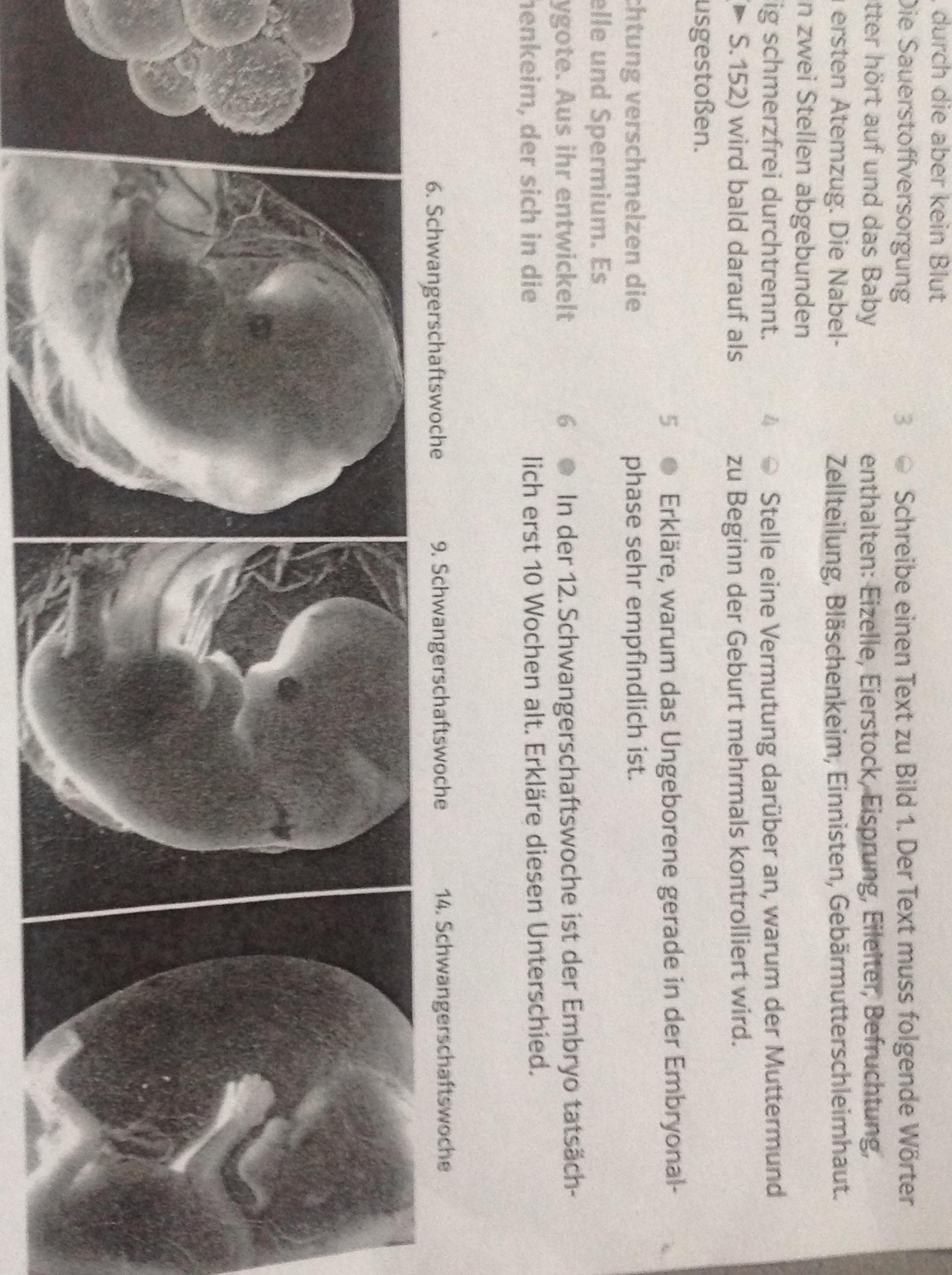 Warum Ist Der Embryo In Der 12 Schwangerschaftswoche Erst 10 Wochen Alt Woche Warum Ist Der Embryo In Der 12 Schwangerschaftswoche Erst 10 Wochen Alt Woche