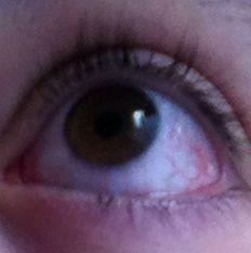 Auge  - (Gesundheit, Augen, rot)